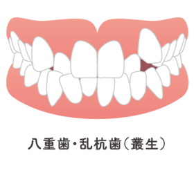 症例