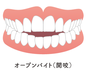 症例