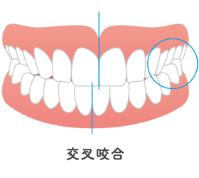 症例