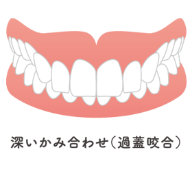 症例