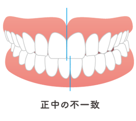 症例
