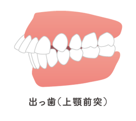 症例