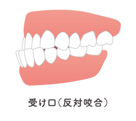 症例