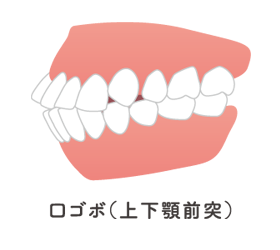 症例